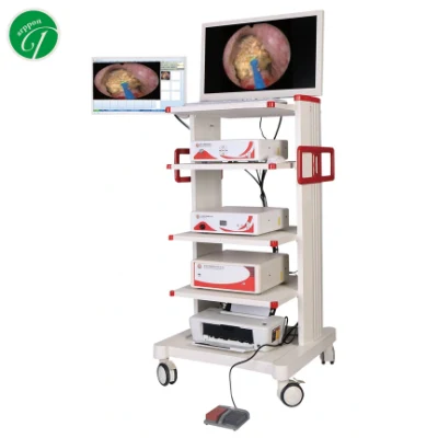 Conjunto completo de endoscópio de urologia, equipamento endoscópico de câmera de cistoscópio de urologia